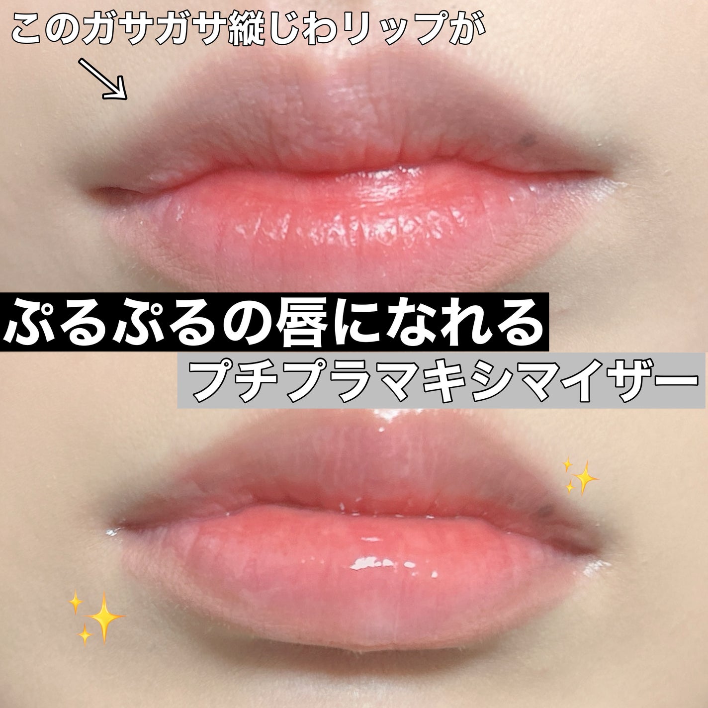 ボリュームリッププランパー/BANILA CO/リッププランパーを使ったクチコミ(1枚目)