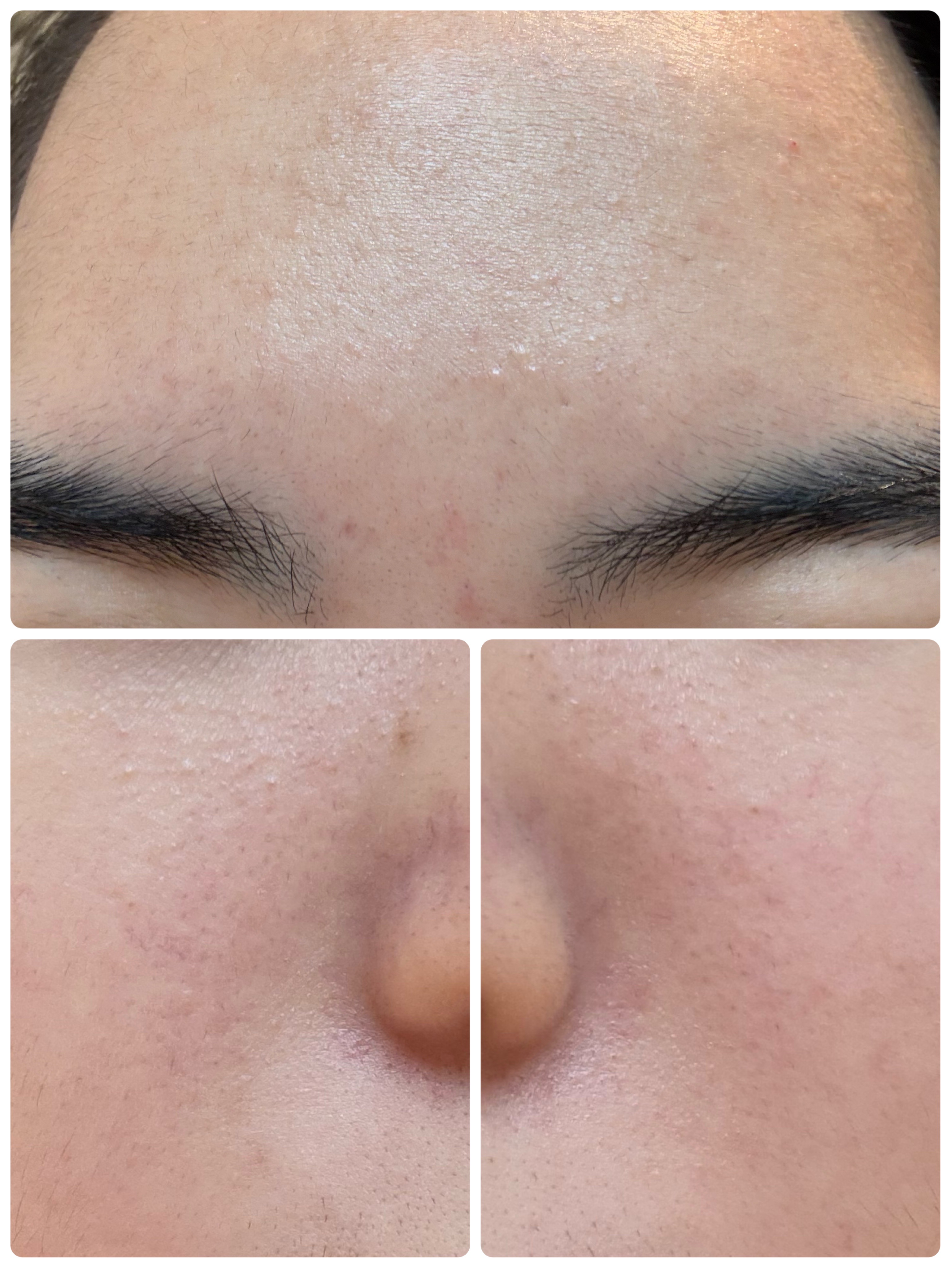 AGE-R ブースタープロ/MEDICUBE/美顔器・マッサージを使ったクチコミ（3枚目）