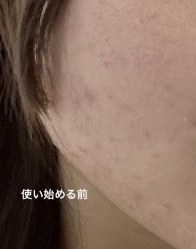 ザ・タイムR アクア 200ml/IPSA/化粧水を使ったクチコミ（2枚目）