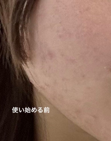 ザ・タイムR アクア/IPSA/化粧水を使ったクチコミ(2枚目)