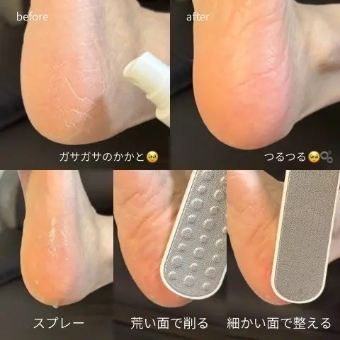 フットケアセット/BAREN/その他キットセットを使ったクチコミ(2枚目)