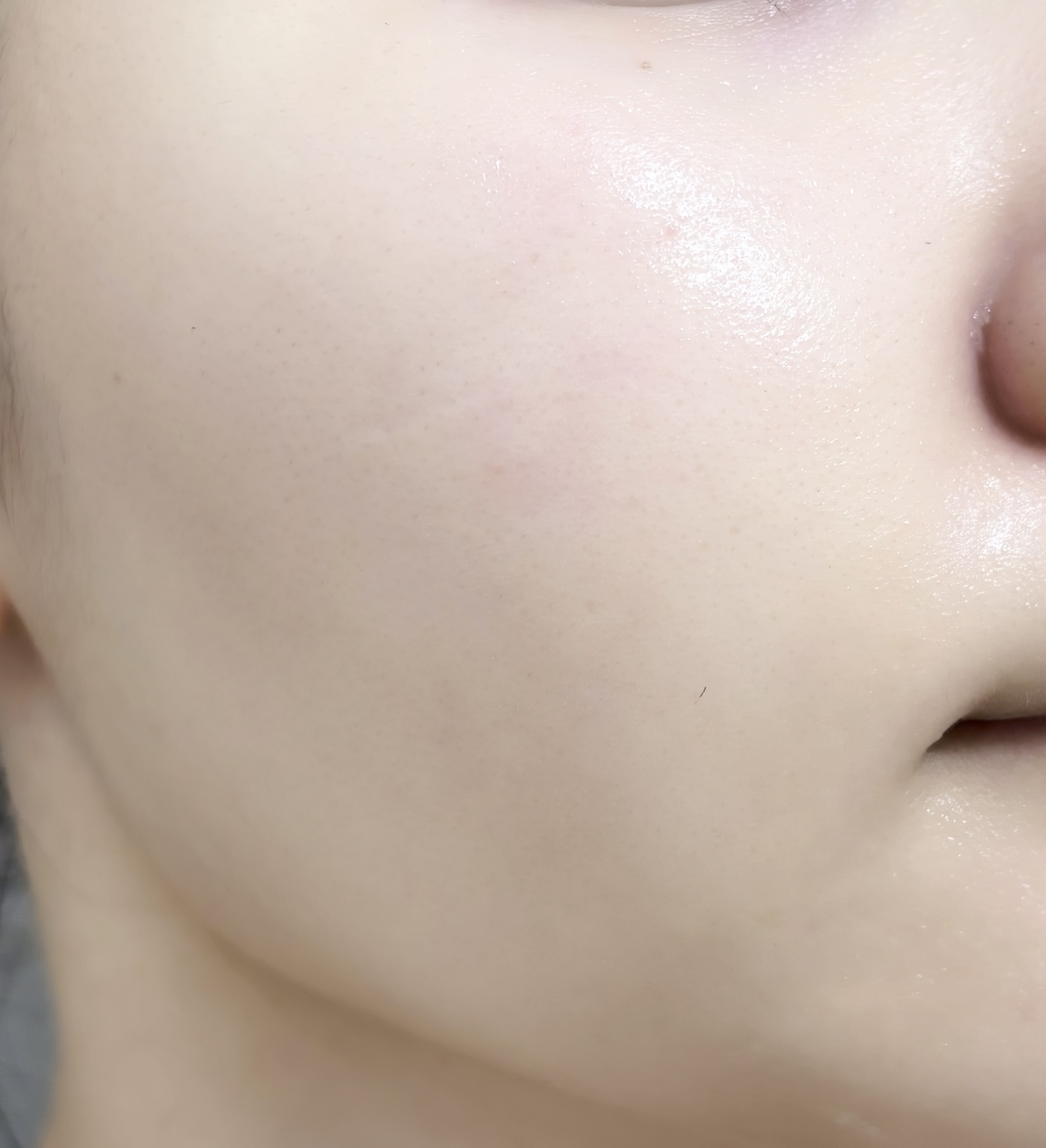 ヨエスターグルタチオンダイレクト５X/ESTHER FORMULA/美容サプリメントを使ったクチコミ（3枚目）