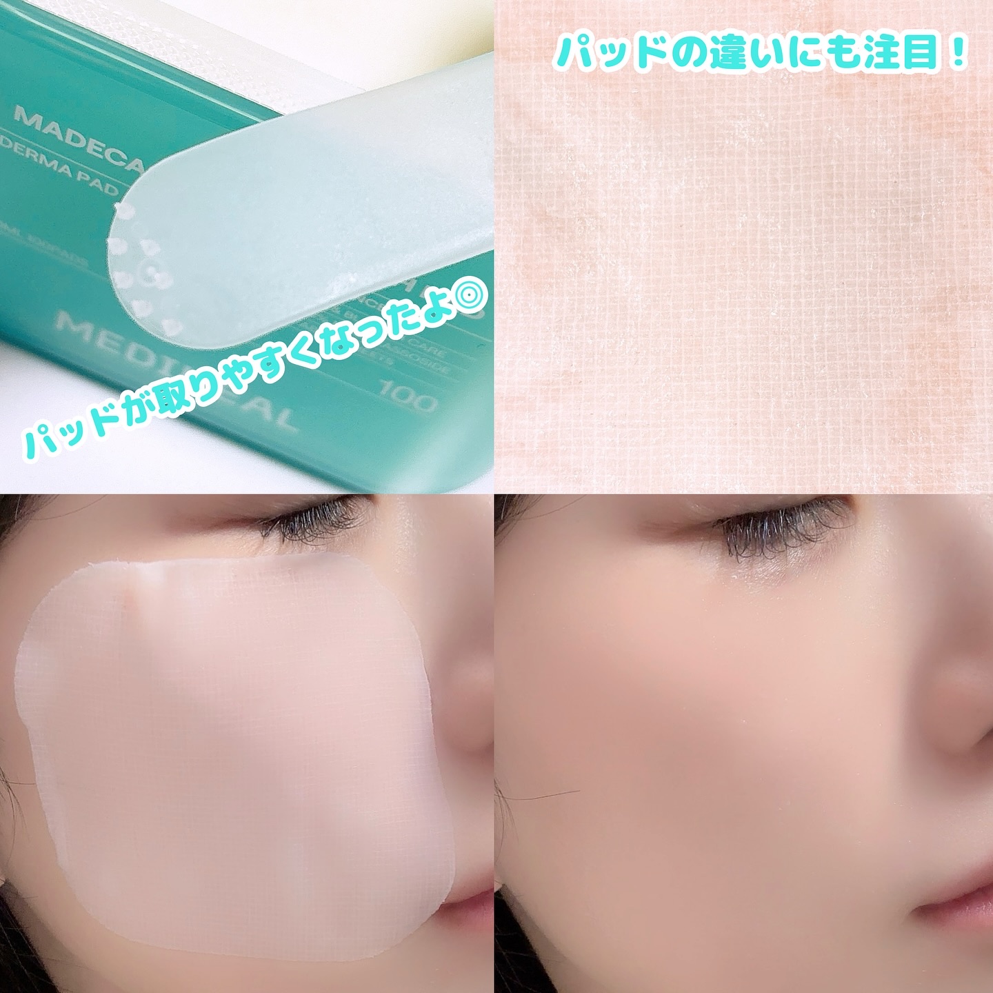 マデカソサイド ブレミッシュパッド/MEDIHEAL/トナーパッドを使ったクチコミ（3枚目）