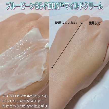 ブルービーンB5-PDRN™マイルドローション/BRING GREEN/乳液を使ったクチコミ(5枚目)