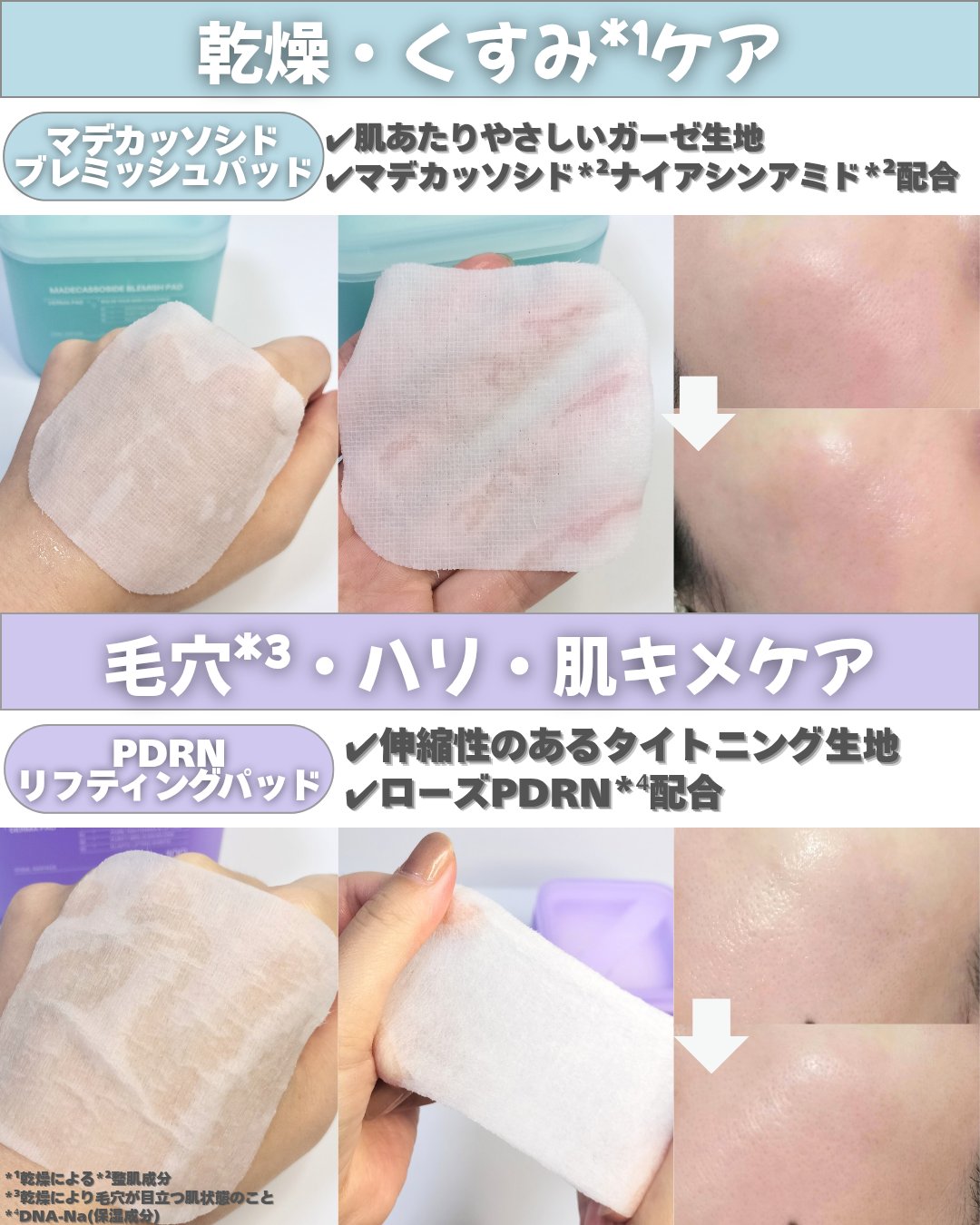 マデカソサイド ブレミッシュパッド/MEDIHEAL/トナーパッドを使ったクチコミ（2枚目）