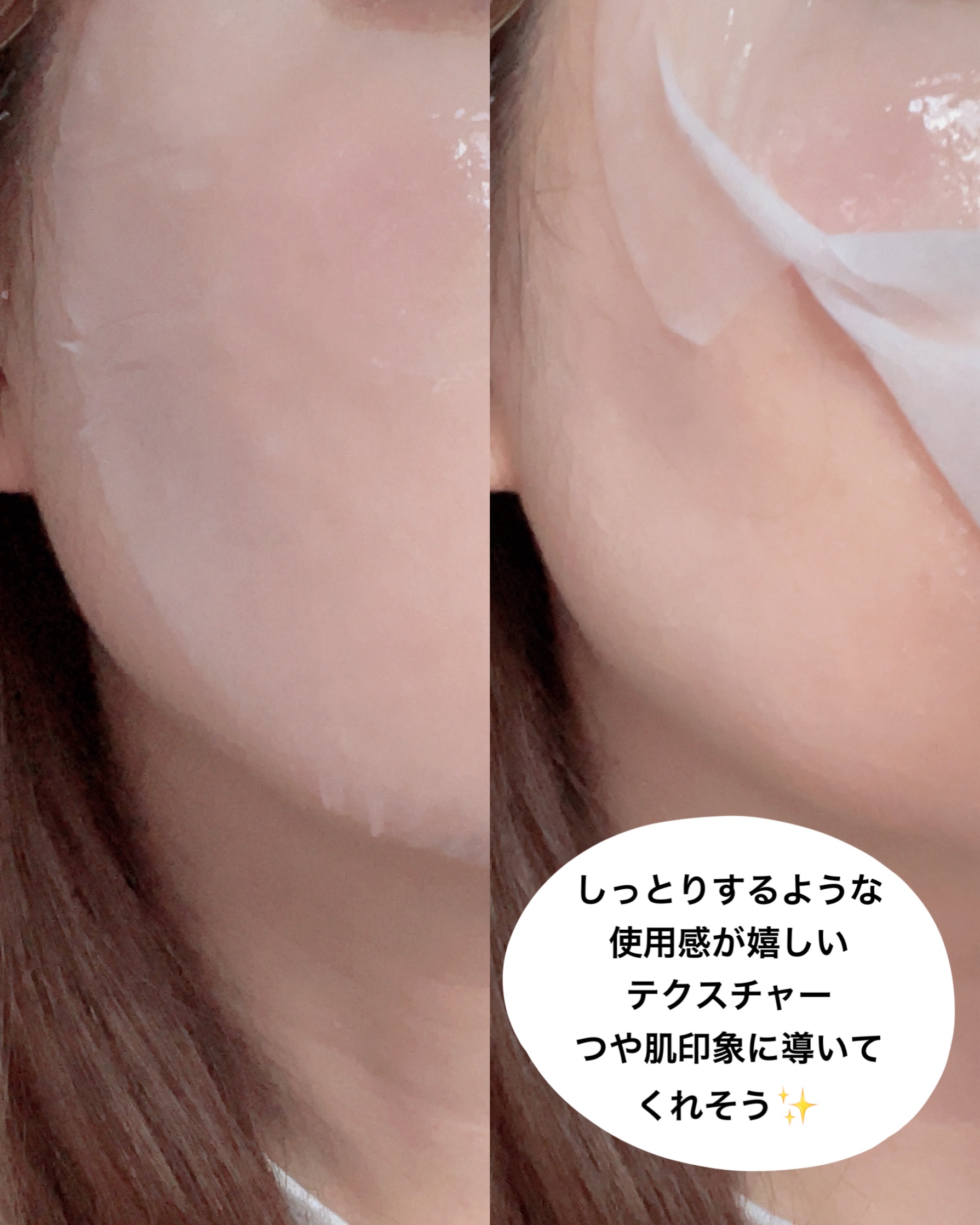 ローゼPDRNエッセンシャルマスクヘルシーグロウ/MEDIHEAL/シートマスク・パックを使ったクチコミ（3枚目）