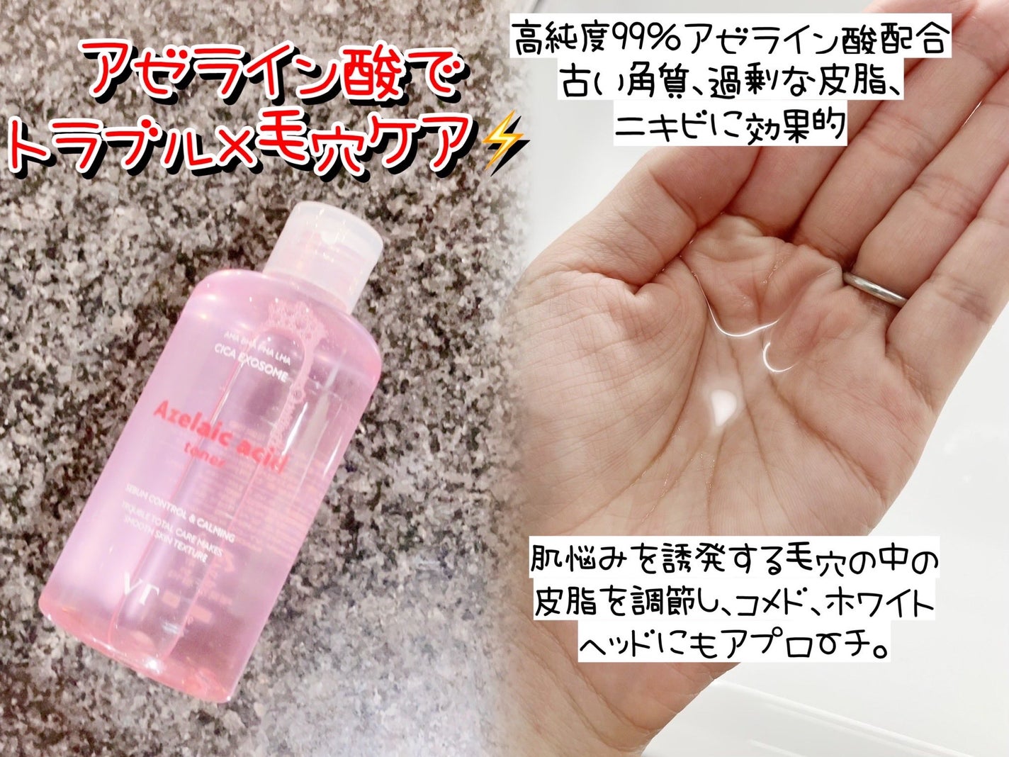 AZケア マスク/VT/シートマスク・パックを使ったクチコミ(2枚目)