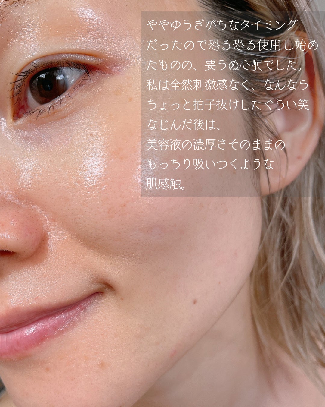 アットクリニック ハイパーPトーニング美容液/DOMINAS/美容液を使ったクチコミ(4枚目)