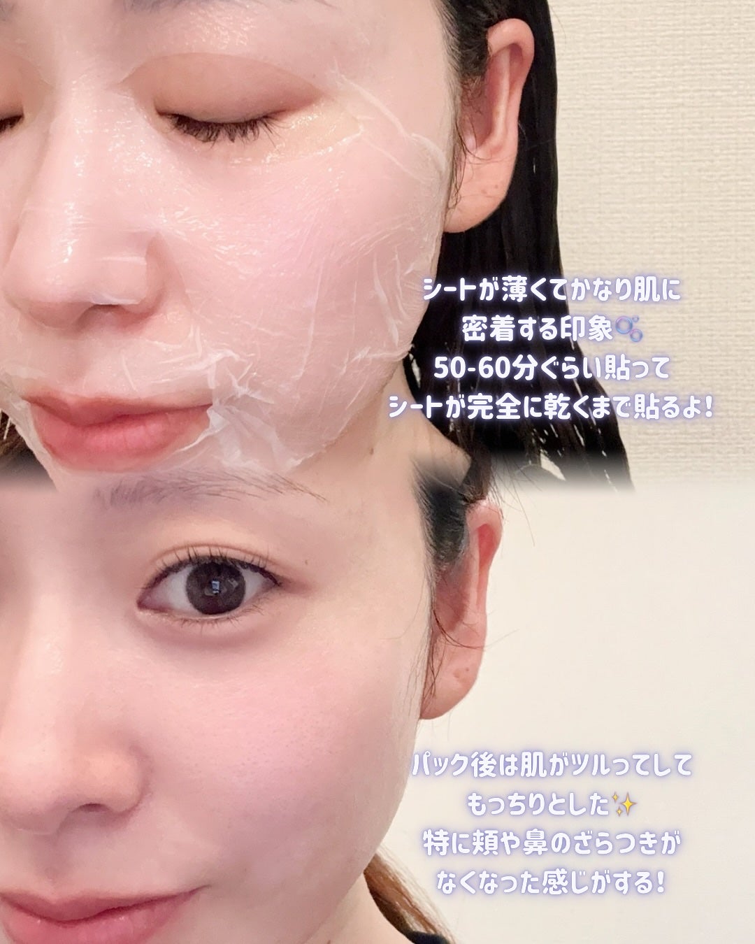 トラブルパッチマスク/EIOM/その他スキンケアを使ったクチコミ(4枚目)