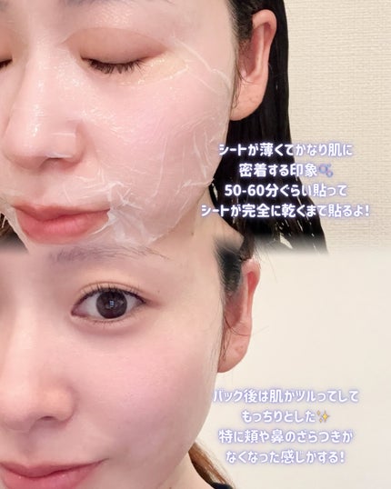 トラブルパッチマスク/EIOM/その他スキンケアを使ったクチコミ(4枚目)