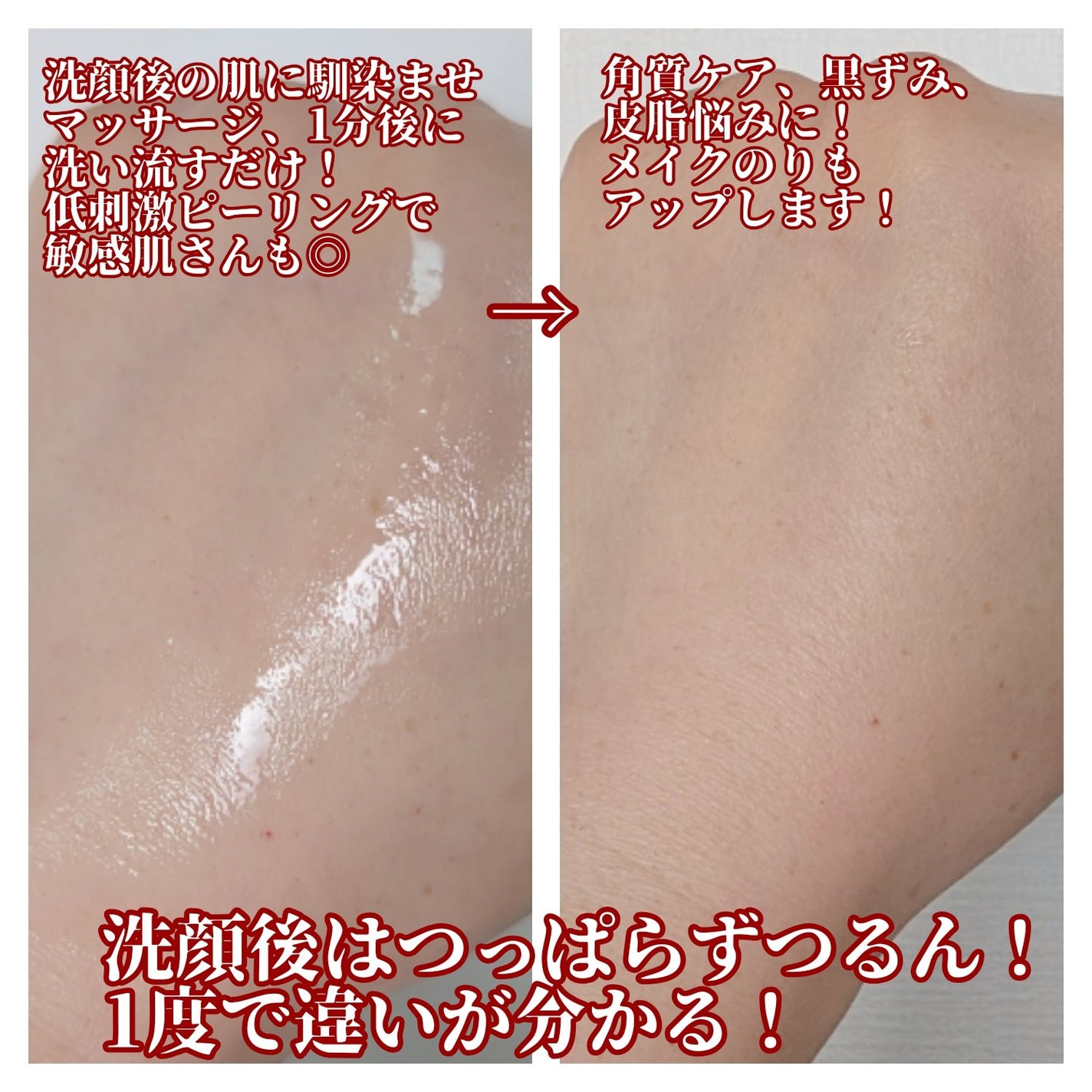 AHA 9.12 オミジャ 陶器肌 ウォッシュオフ セラム/parnell/美容液を使ったクチコミ(2枚目)