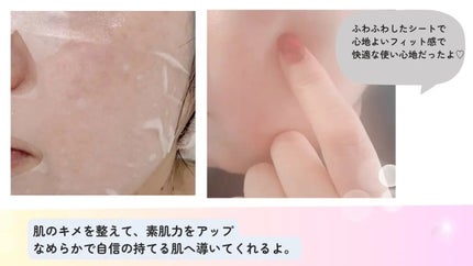 ローゼPDRNエッセンシャルマスクヘルシーグロウ/MEDIHEAL/シートマスク・パックを使ったクチコミ(3枚目)