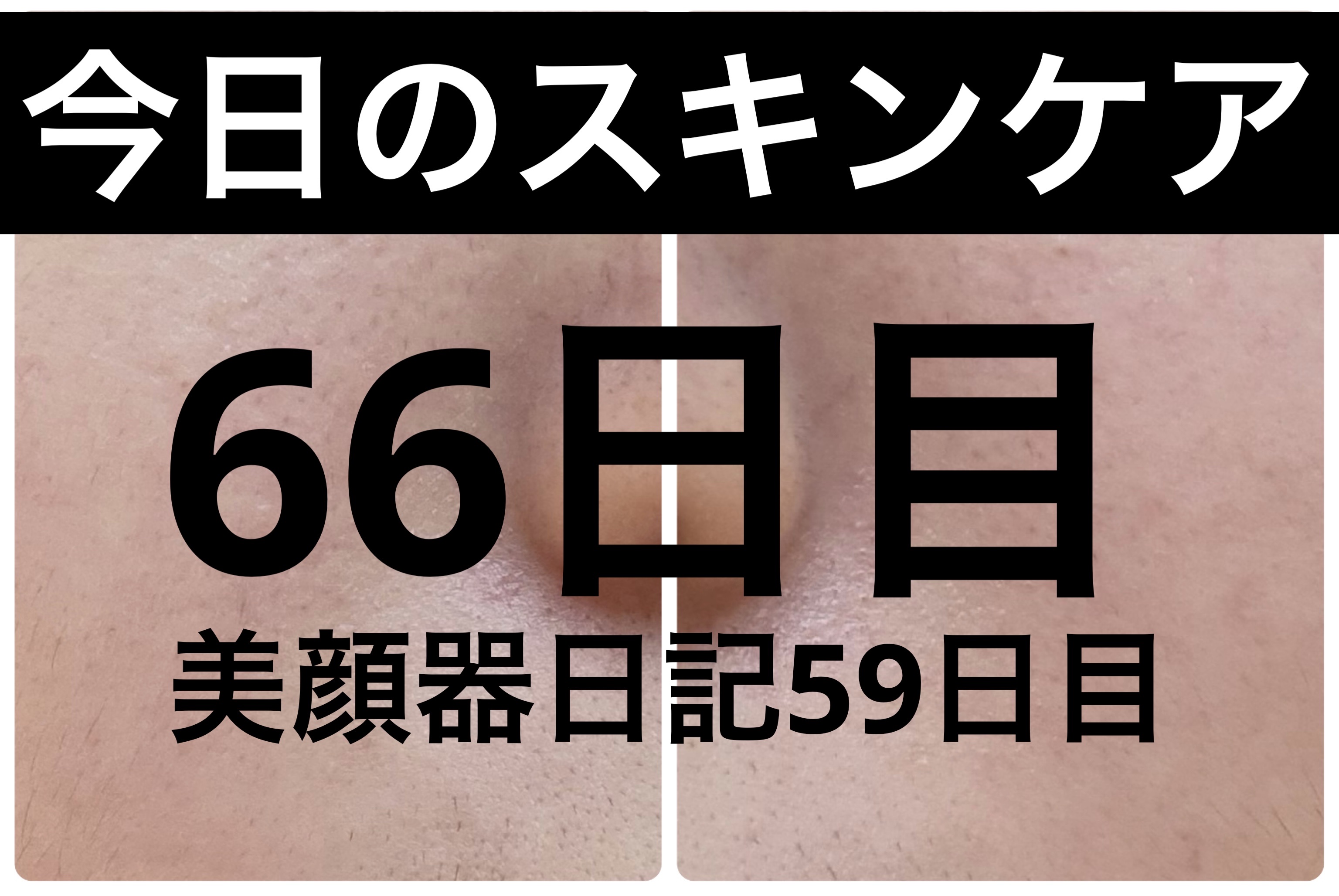 AGE-R ブースタープロ/MEDICUBE/美顔器・マッサージを使ったクチコミ（1枚目）