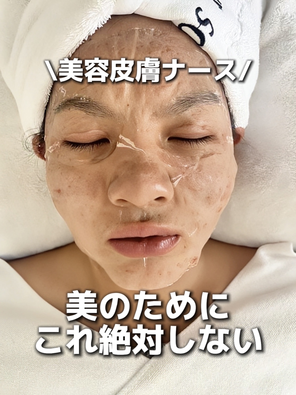 アネトス アクネケア トリートメント セラム/Anetos/美容液を使ったクチコミ（1枚目）