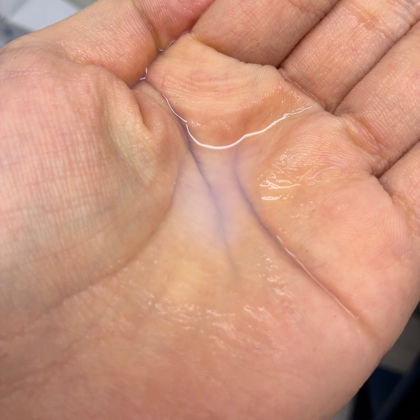 薬用化粧水/スキンライフ/化粧水を使ったクチコミ(2枚目)