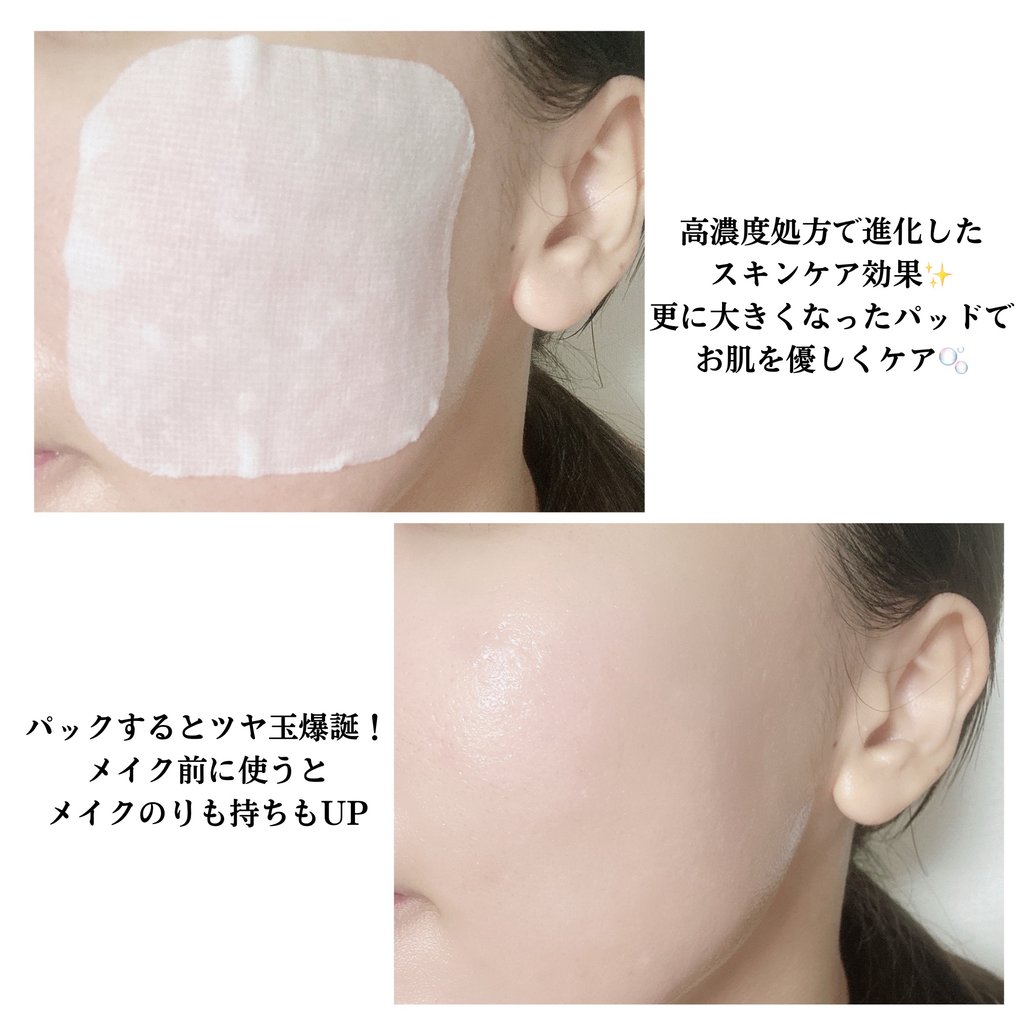 PDRN リフティングパッド/MEDIHEAL/トナーパッドを使ったクチコミ（3枚目）