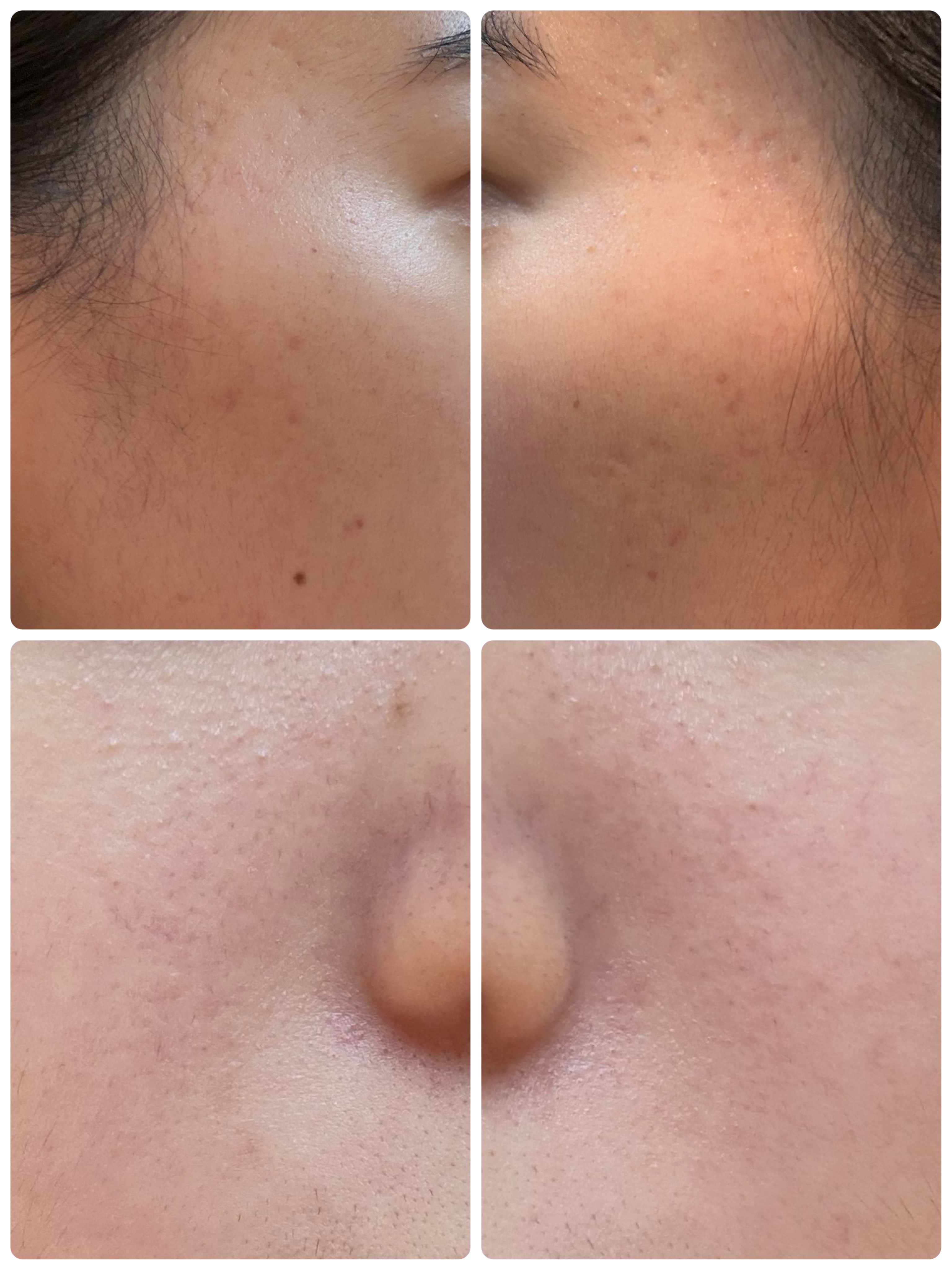 AGE-R ブースタープロ/MEDICUBE/美顔器・マッサージを使ったクチコミ（2枚目）