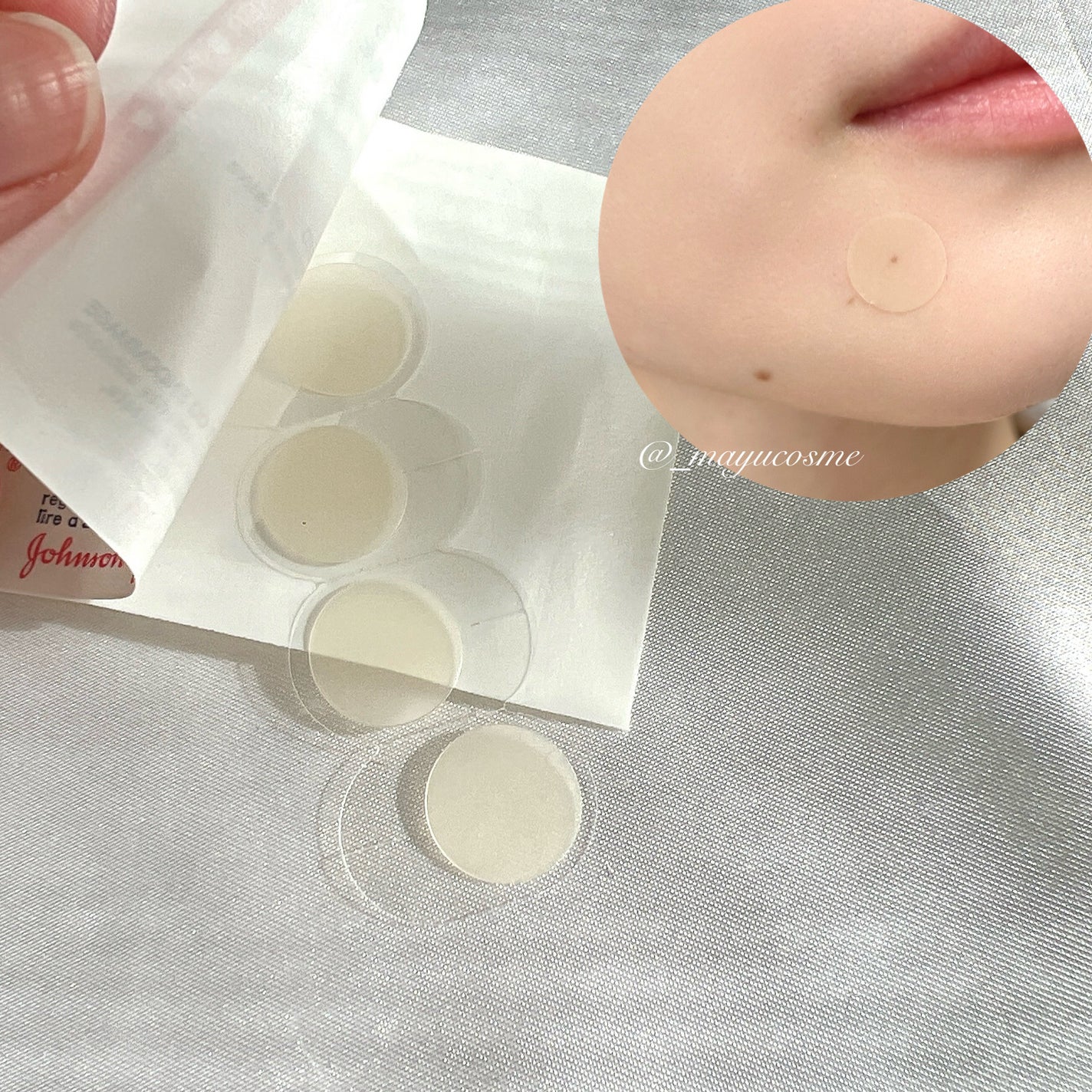 バンドエイド 顔用パッチ/バンドエイド/その他スキンケアを使ったクチコミ(2枚目)