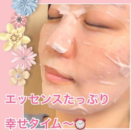 ローゼPDRNエッセンシャルマスクヘルシーグロウ/MEDIHEAL/シートマスク・パックを使ったクチコミ(4枚目)