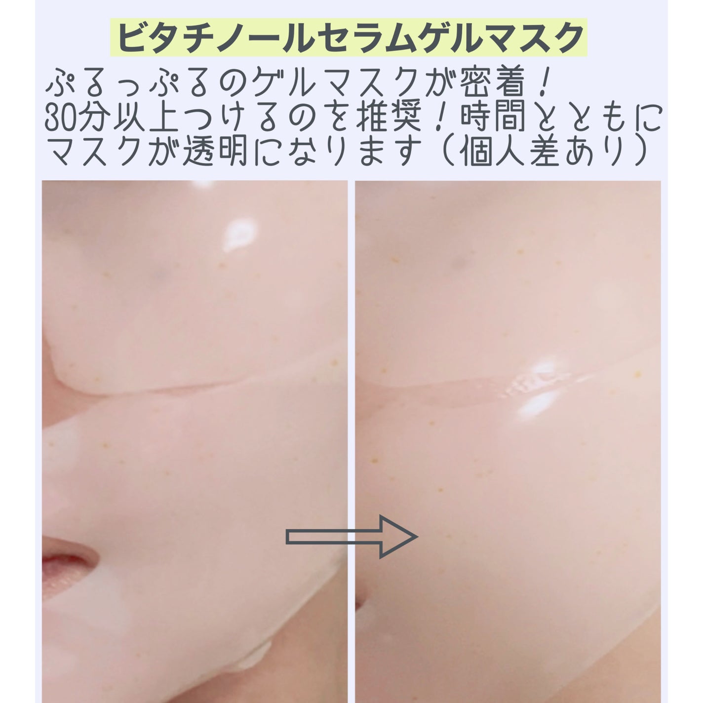 ユース ラディアンス ビタチノール セラム/primera/美容液を使ったクチコミ(5枚目)