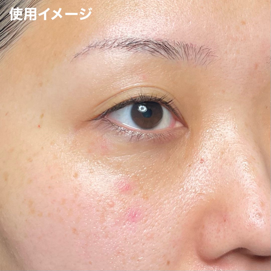 薬用化粧水/スキンライフ/化粧水を使ったクチコミ(9枚目)