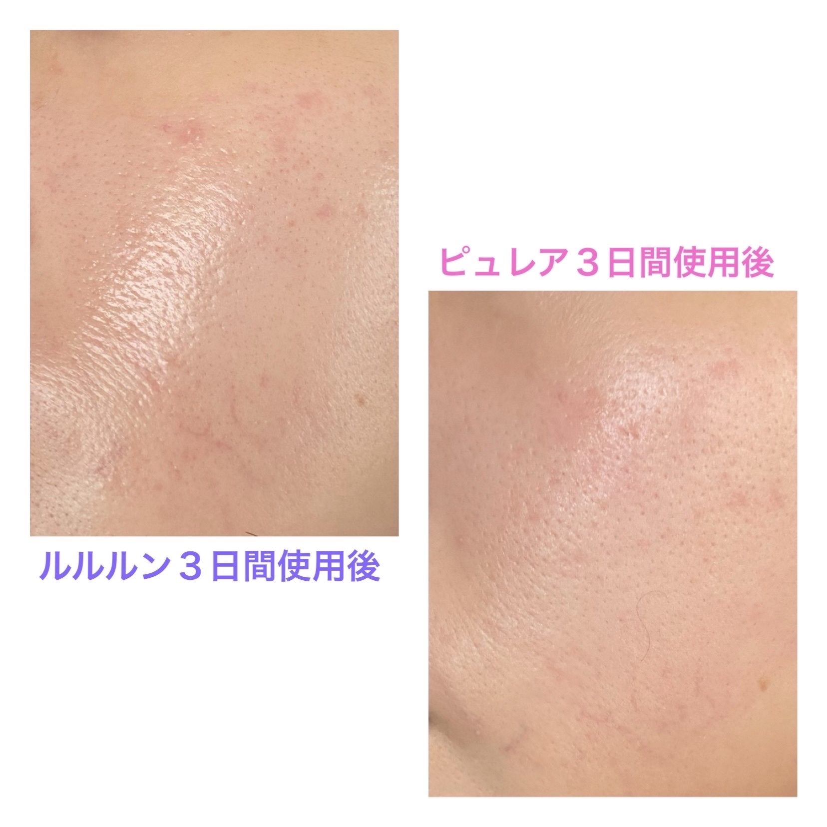 リジュオンリペアエッセンスマスク/ピュレア/シートマスク・パックを使ったクチコミ（2枚目）