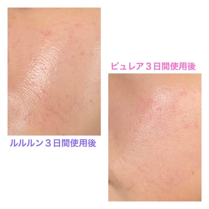 ルルルン ハイドラ EX マスク/ルルルン/シートマスク・パックを使ったクチコミ(2枚目)