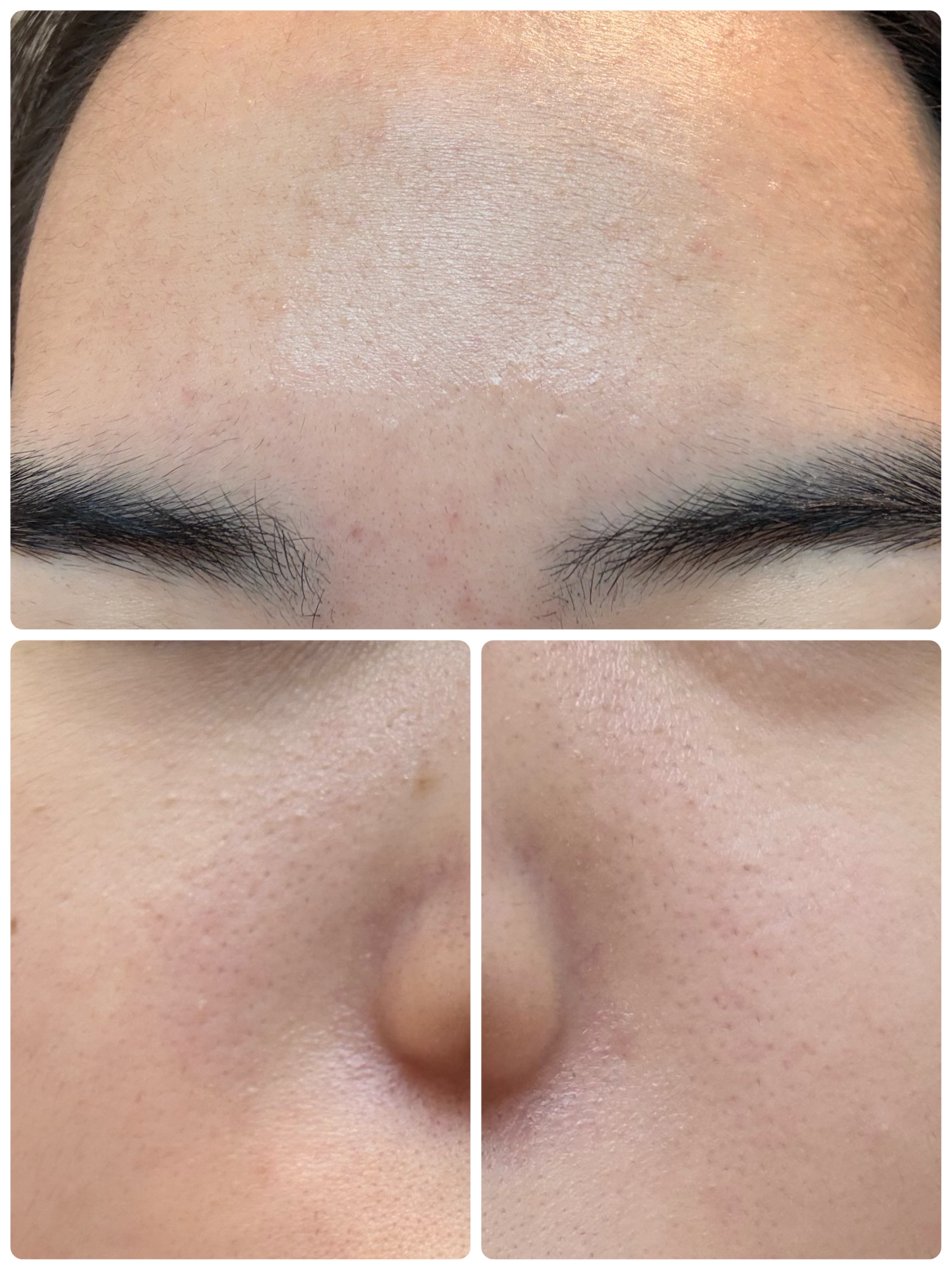 モーニングジェルウォッシュ/ビトレスキン/その他洗顔料を使ったクチコミ（3枚目）