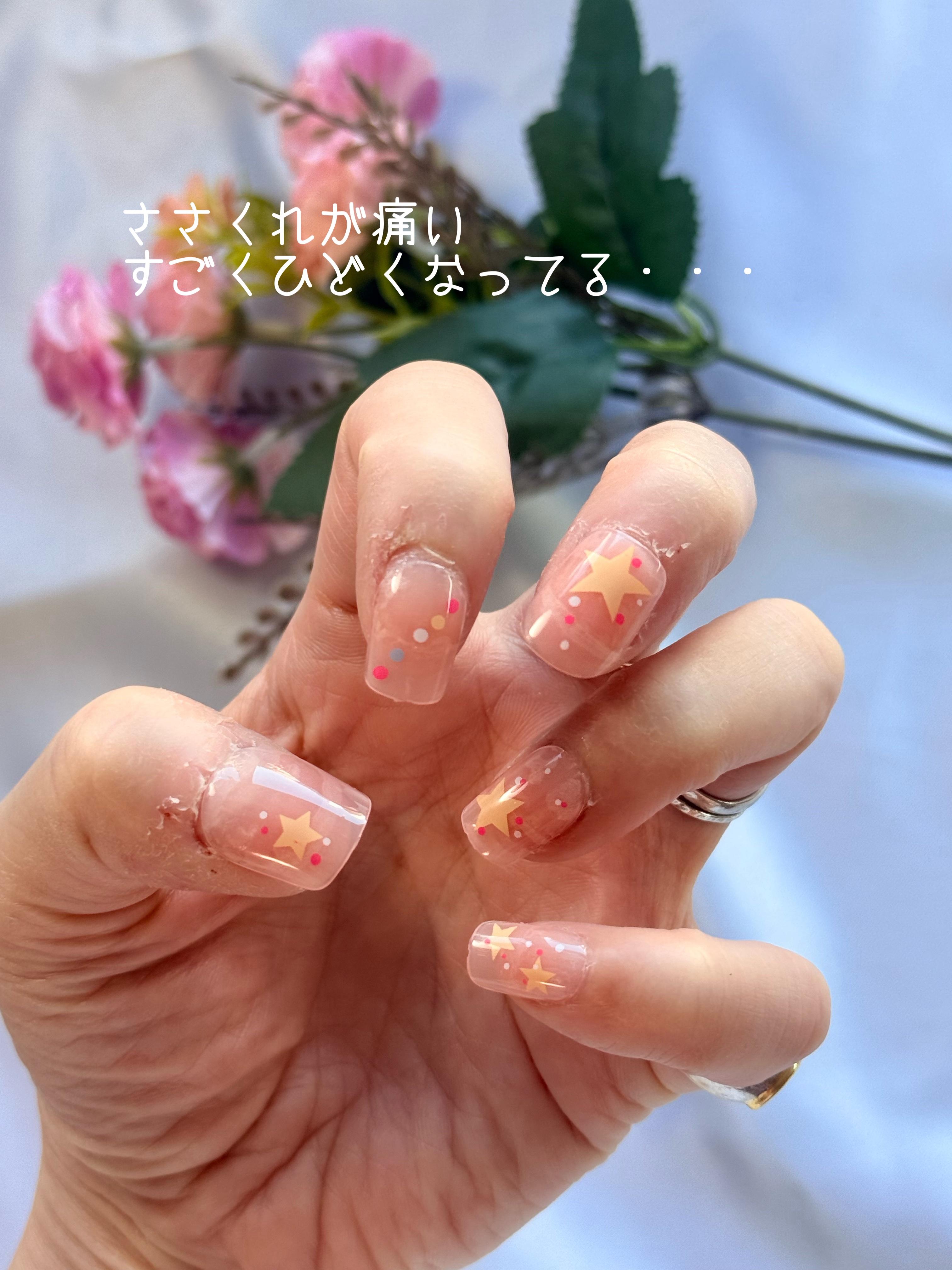 ネイルチップ/SHEIN/ネイルチップ・パーツを使ったクチコミ（2枚目）