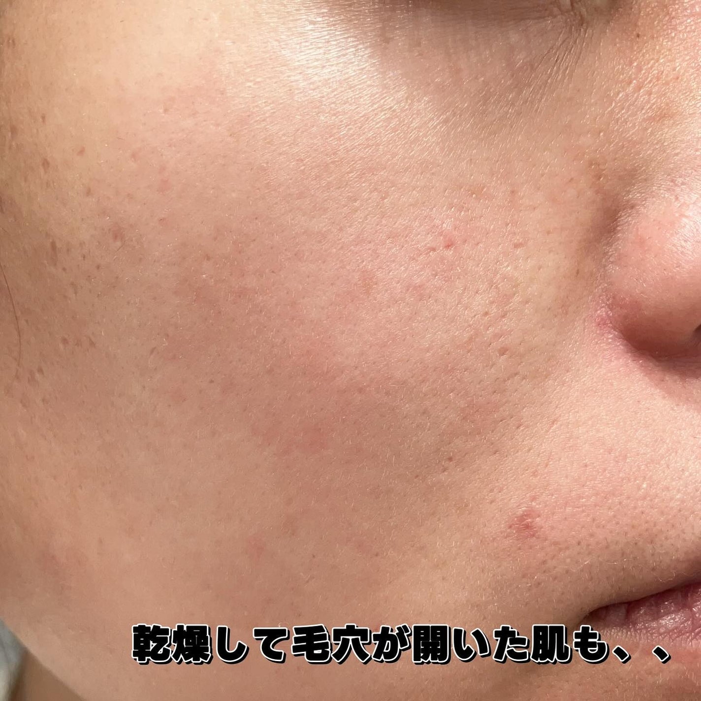 モイスチャートリートメントクリーム/celq:ne/フェイスクリームを使ったクチコミ(7枚目)