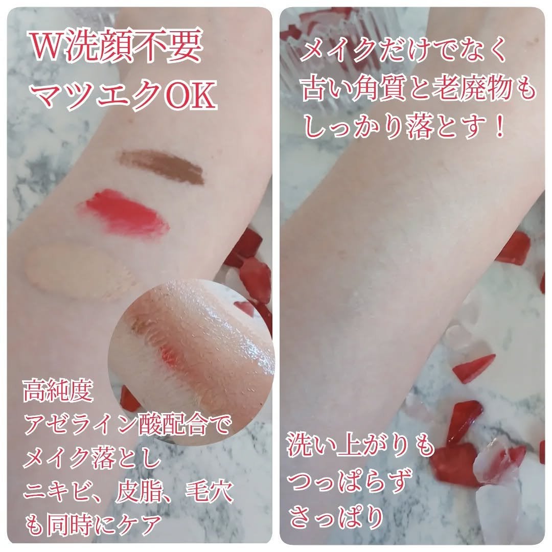 フラミンゴ🦩 on LIPS 「・・VTアゼライン酸クレンジングオイル200ml透明感のある綺..」(5枚目)