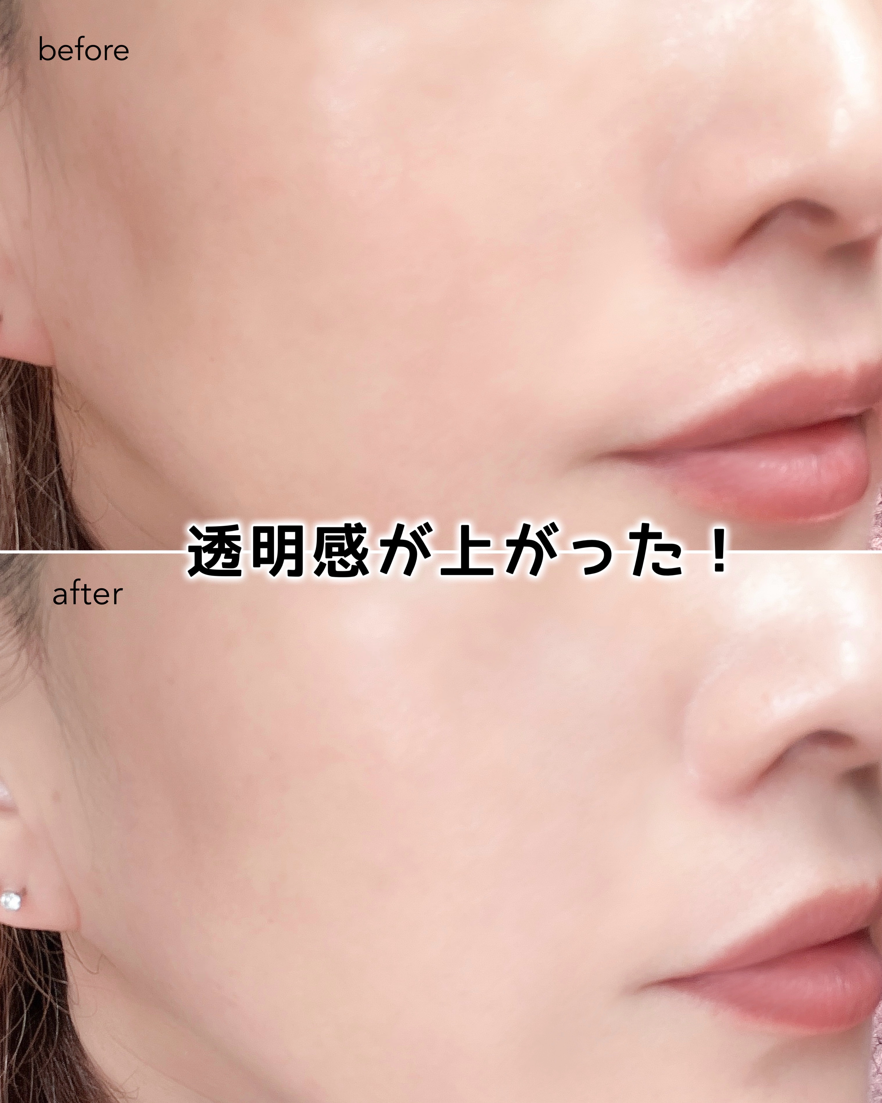 ミシャ ビタシープラス 薬用ブライトニング美容液/MISSHA/美容液を使ったクチコミ（3枚目）