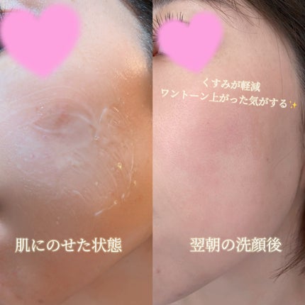 もんちゃん@フォロバ100 on LIPS 「#PR寝ている間に美白をめざすクリームタイプのナイトパック🌙*..」(4枚目)