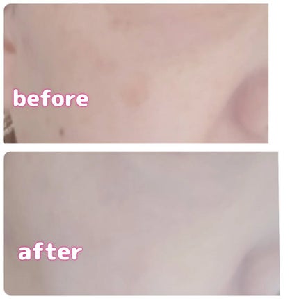 マーメイド🩷 on LIPS 「・・TFITカバーアッププロコンシーラー15gコンパクトオー..」(5枚目)