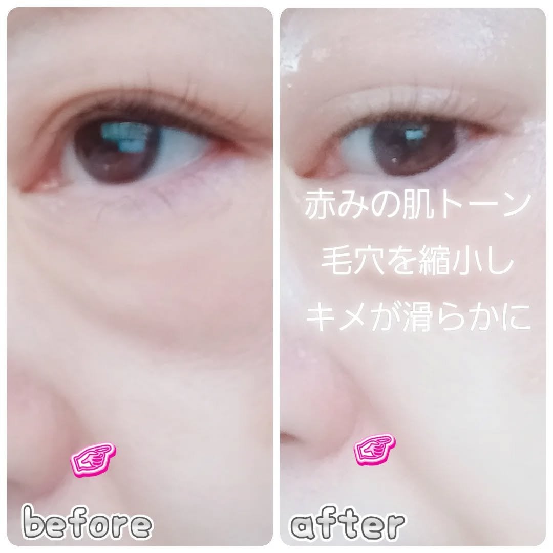マーメイド🩷 on LIPS 「・・OPIGENナイアシンアミド22%+亜鉛30mlセラム透明..」(5枚目)