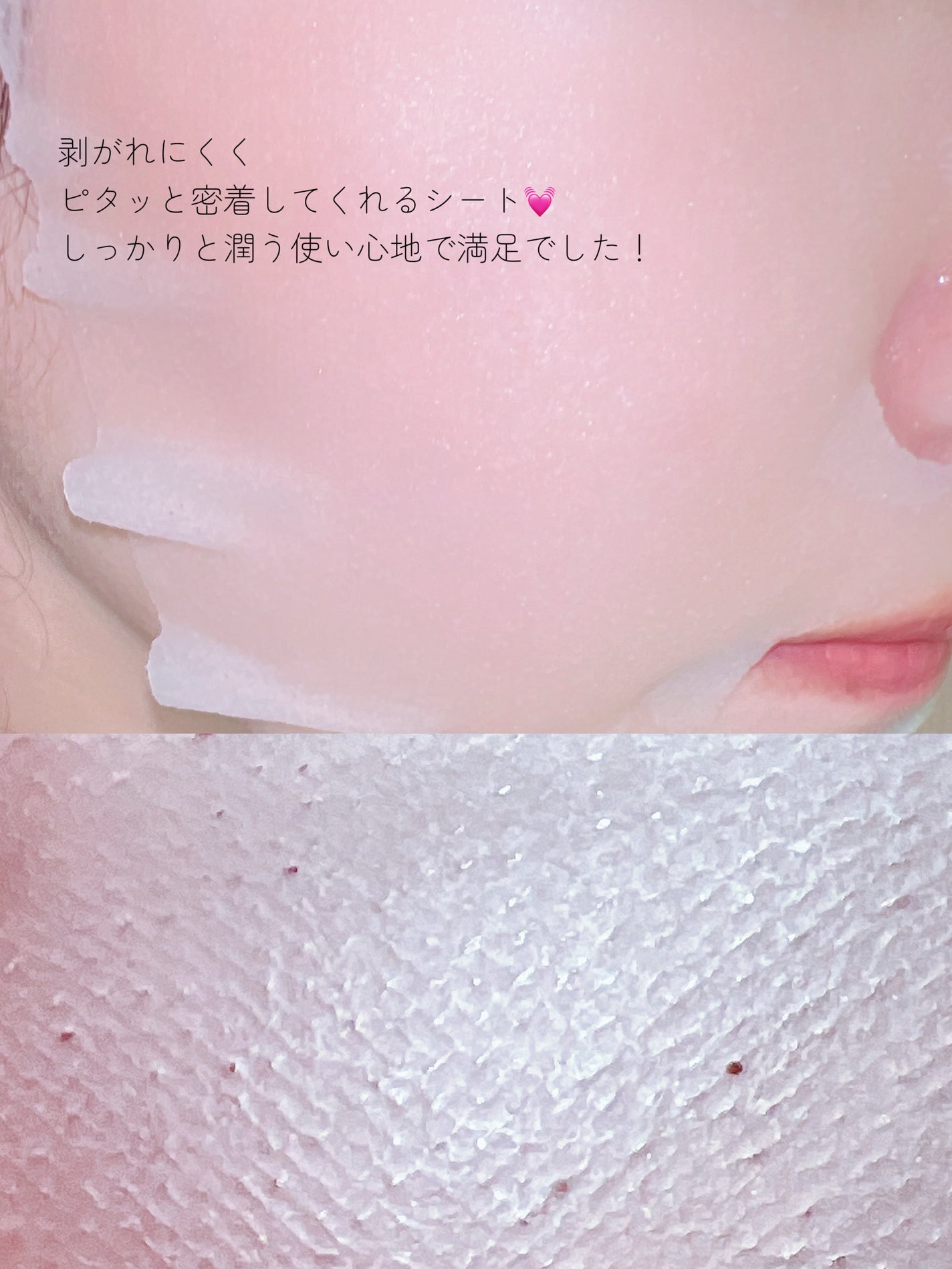 ダーマレーザー スーパーPDRN+VC100マスク/クオリティファースト/シートマスク・パックを使ったクチコミ(2枚目)