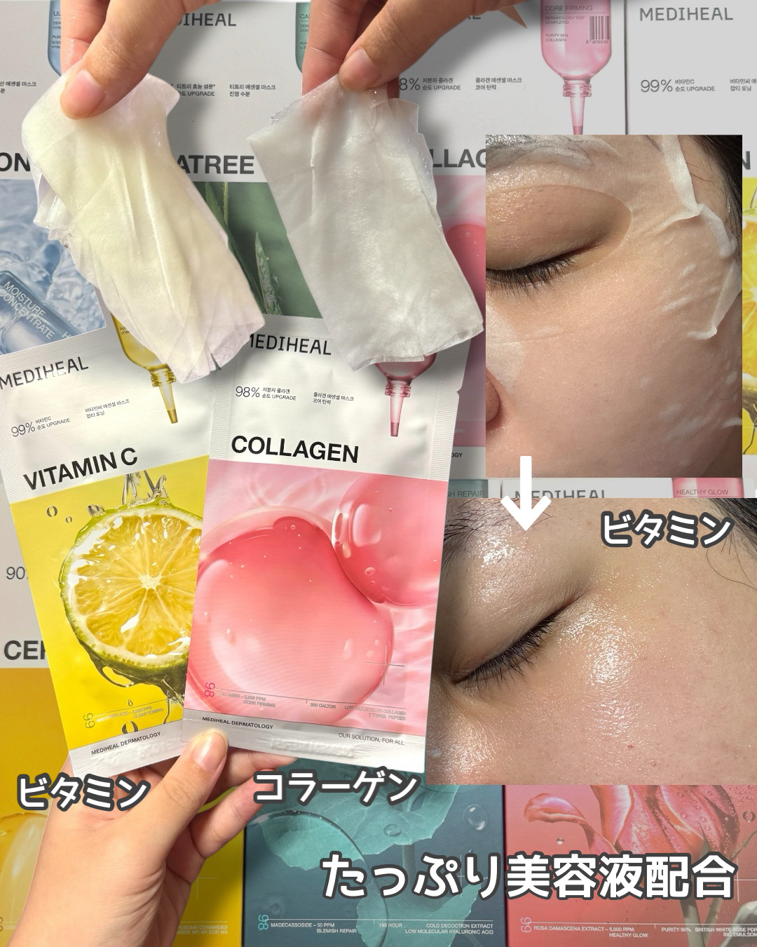 ヒアルロンエッセンシャルマスクウルトラハイドレーション/MEDIHEAL/シートマスク・パックを使ったクチコミ（3枚目）