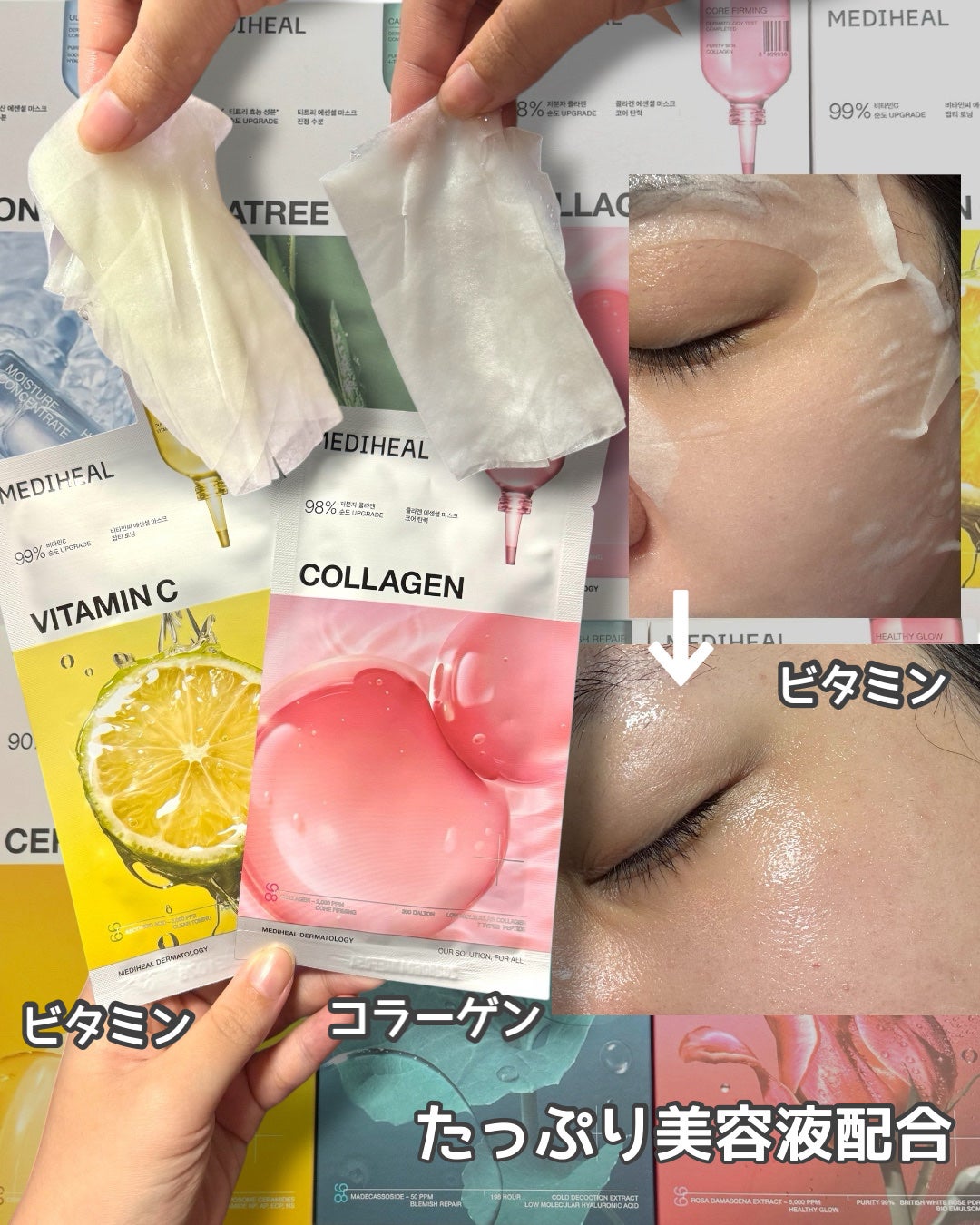 ティーツリー エッセンシャルマスクカーミングモイスチャー/MEDIHEAL/シートマスク・パックを使ったクチコミ(3枚目)