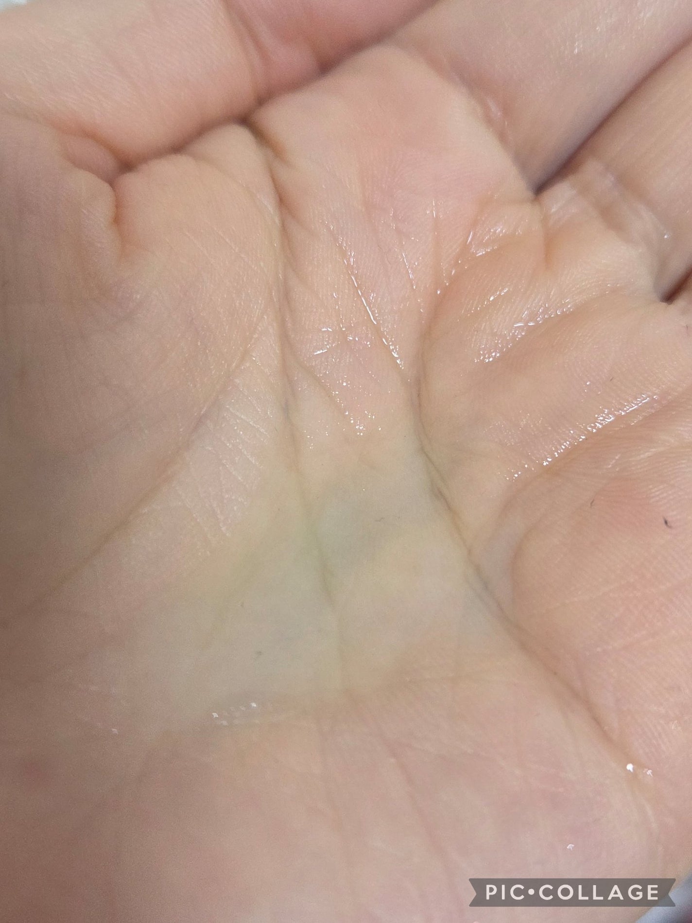 アゼライン酸ナイアシンアミドクリアトナー/MEDICUBE/化粧水を使ったクチコミ(2枚目)