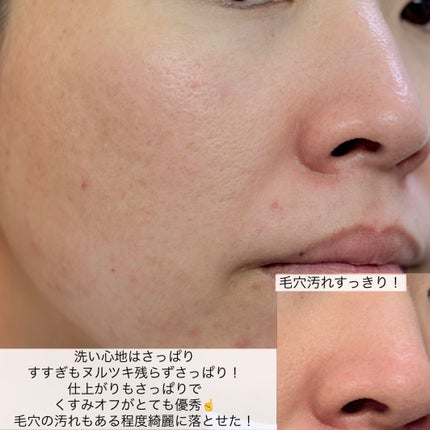 Noni Ampule/celimax/美容液を使ったクチコミ(5枚目)