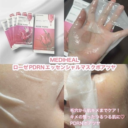 ローゼPDRNエッセンシャルマスクヘルシーグロウ/MEDIHEAL/シートマスク・パックを使ったクチコミ(1枚目)