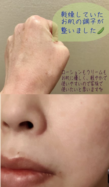 ブルービーンB5-PDRN™マイルドローション/BRING GREEN/乳液を使ったクチコミ(4枚目)