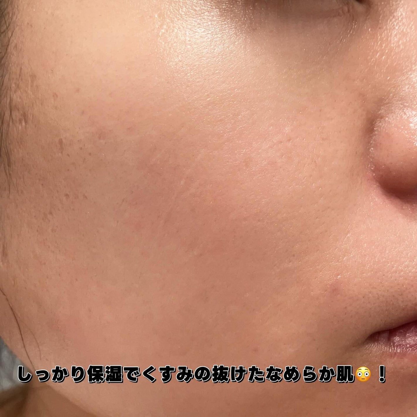 モイスチャートリートメントクリーム/celq:ne/フェイスクリームを使ったクチコミ(8枚目)