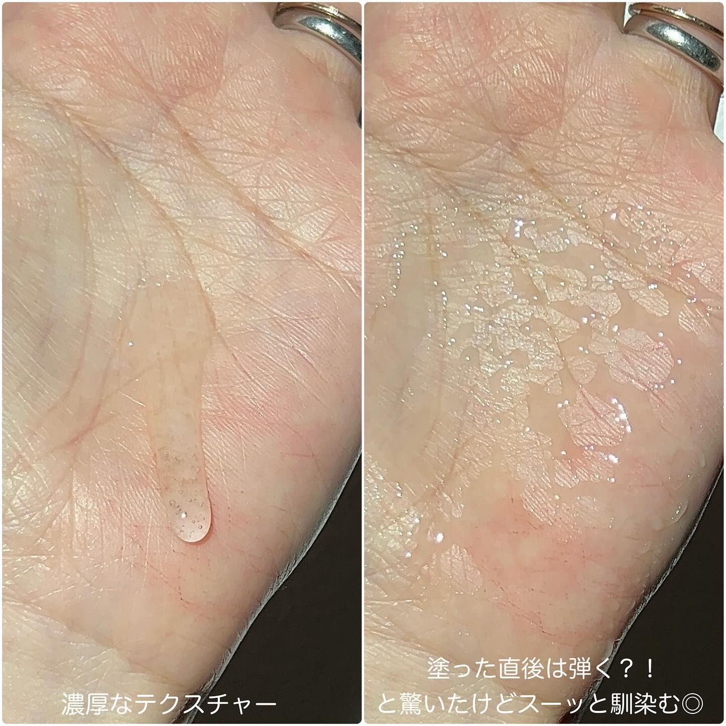 リペアジェル/リソウコーポレーション/美容液を使ったクチコミ（3枚目）