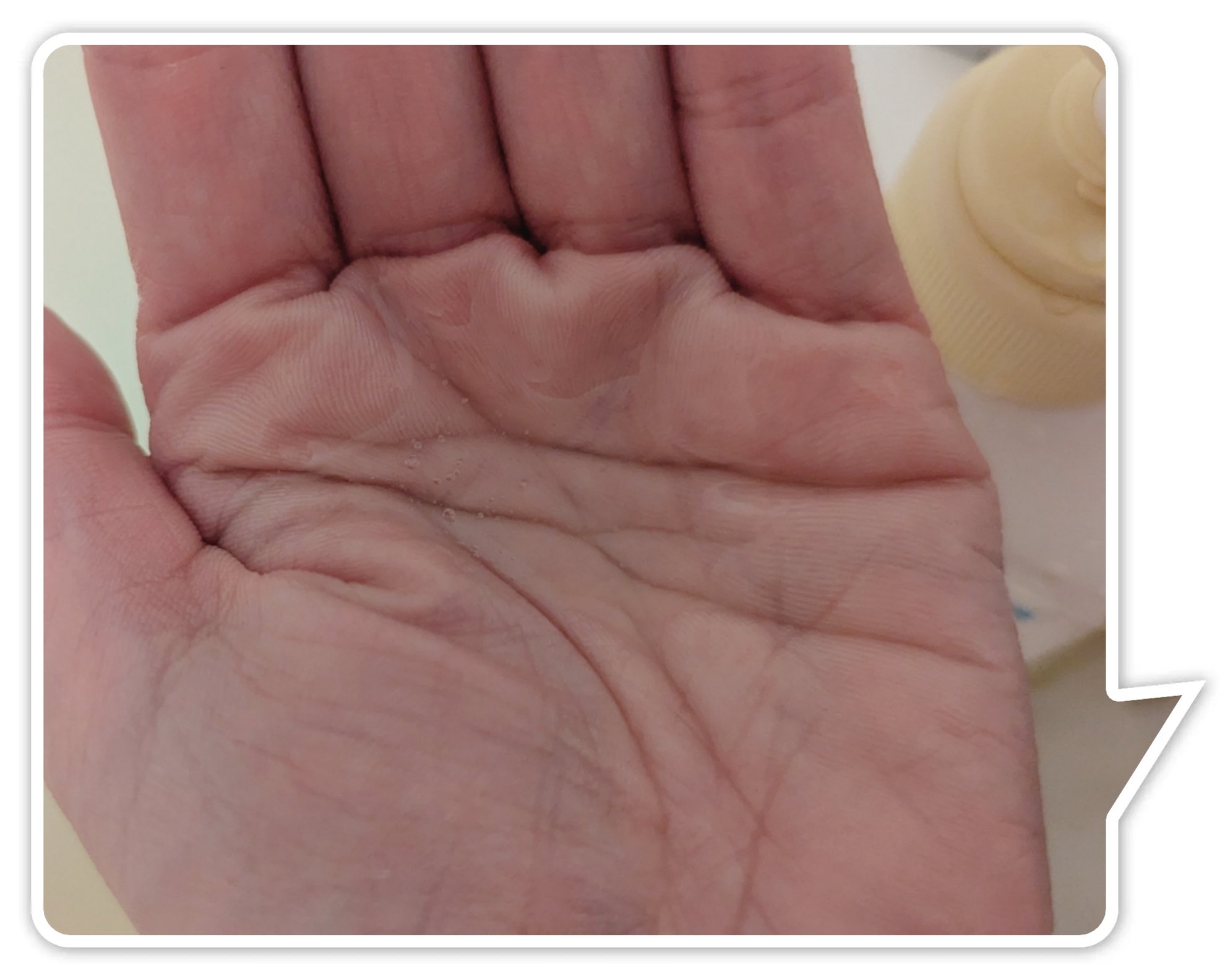 アレルジーナ　抗ヒスタミン成分配合ボディソープ/マックス/ボディソープを使ったクチコミ（2枚目）