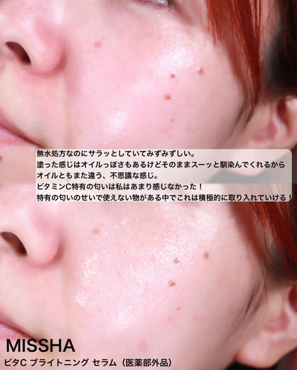 ビタシープラス 化粧水/MISSHA/化粧水を使ったクチコミ(3枚目)
