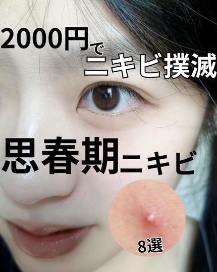 オードムーゲ 薬用ローション(ふきとり化粧水)/オードムーゲ/拭き取り化粧水を使ったクチコミ(1枚目)