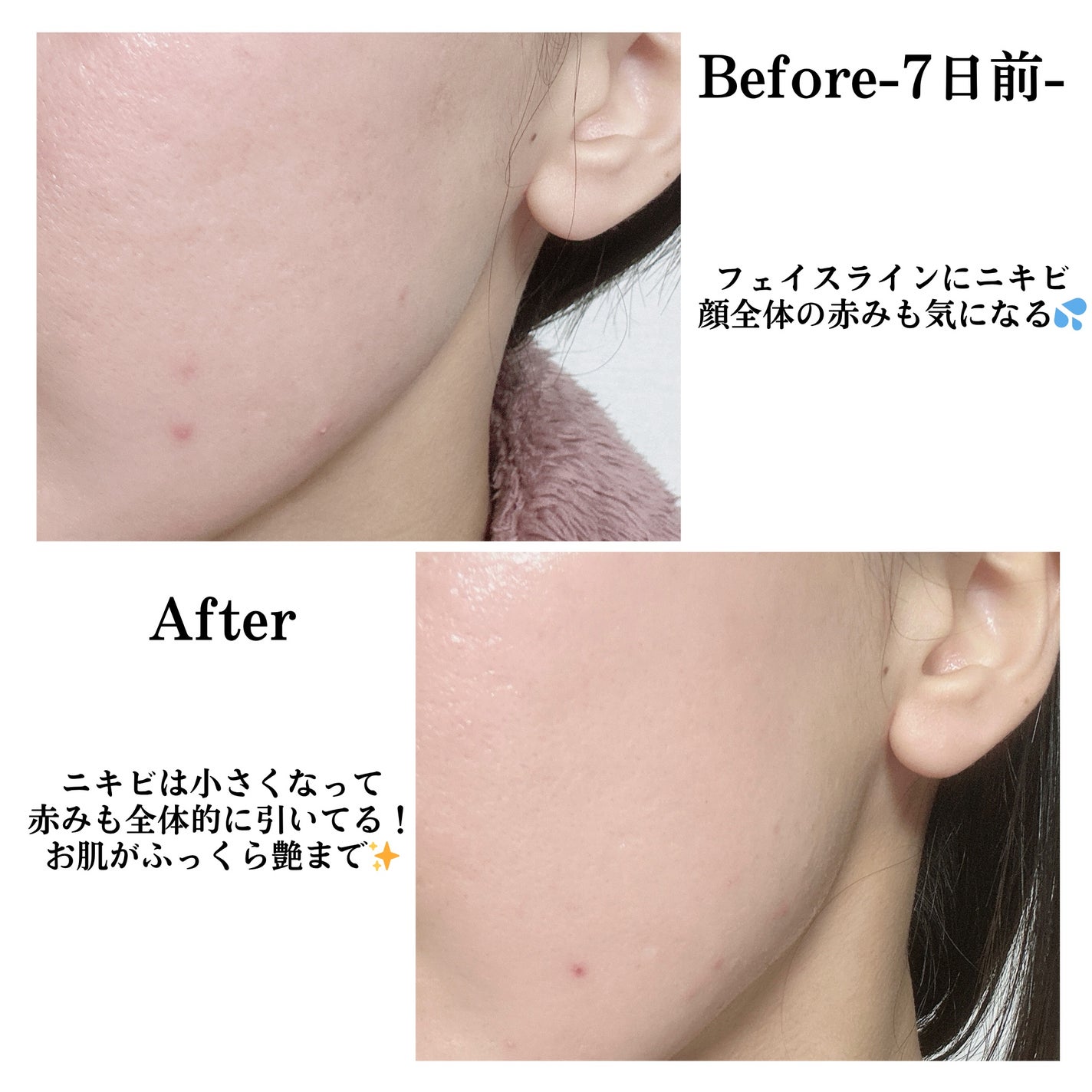 ミシャ ビタシープラス 薬用ブライトニング美容液/MISSHA/美容液を使ったクチコミ(3枚目)