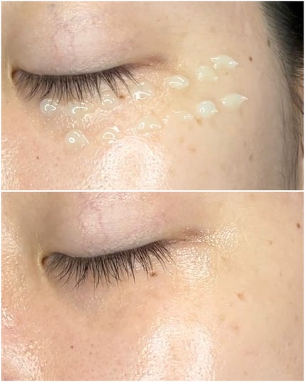 デュアルPDRNカーミングクリーム/MEDI IN LAB/フェイスクリームを使ったクチコミ(4枚目)