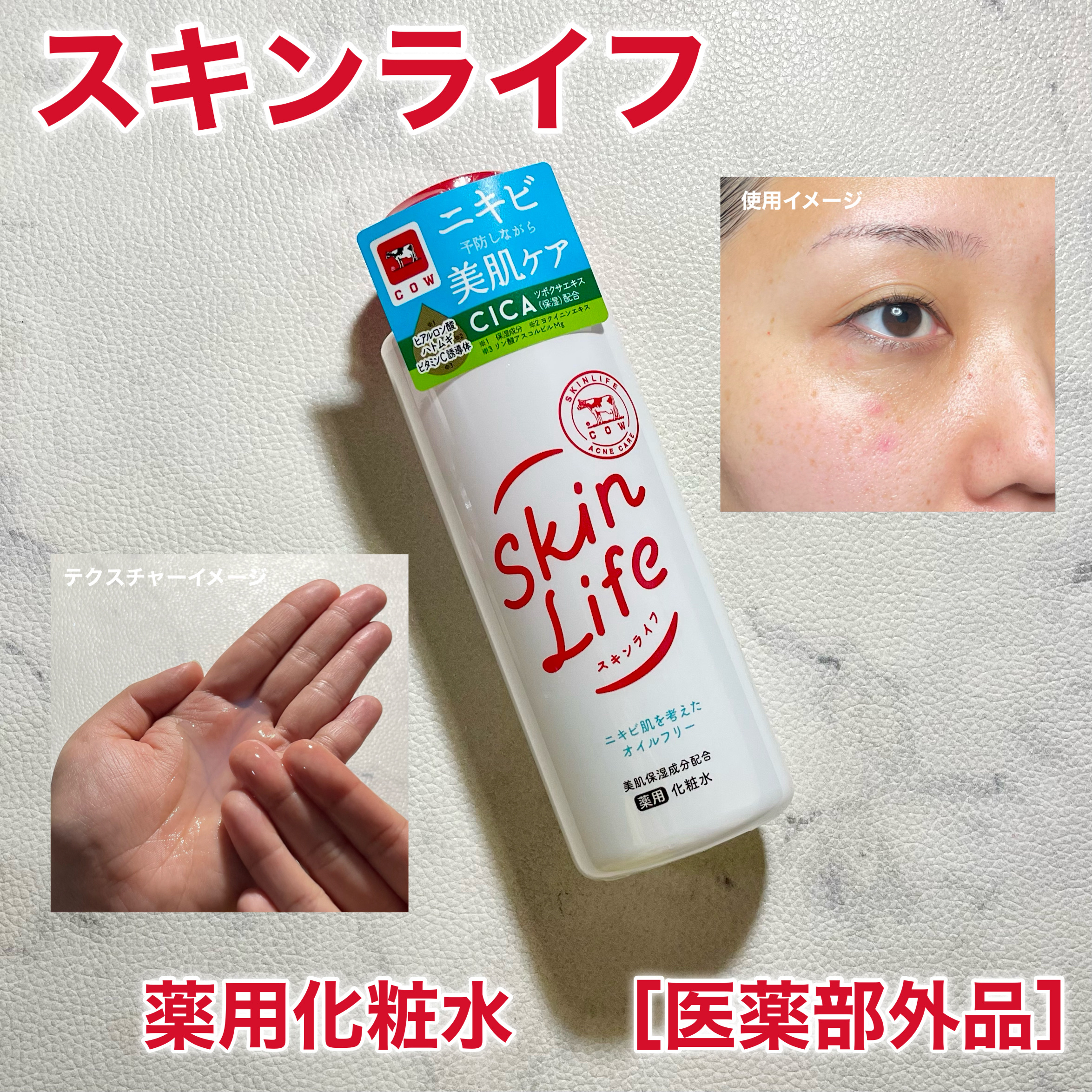 薬用化粧水/スキンライフ/化粧水を使ったクチコミ（1枚目）